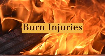 phoenix burn injury lawyer